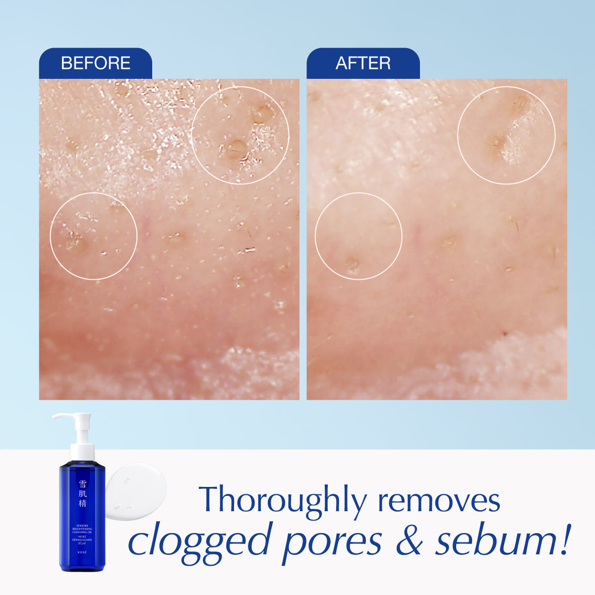 SEKKISEI BRIGHTENING CLEANSING OIL