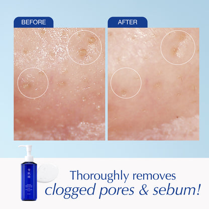SEKKISEI BRIGHTENING CLEANSING OIL